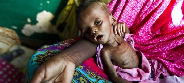 Al menos 26 personas mueren de hambre en Somalia por la sequía en día y medio